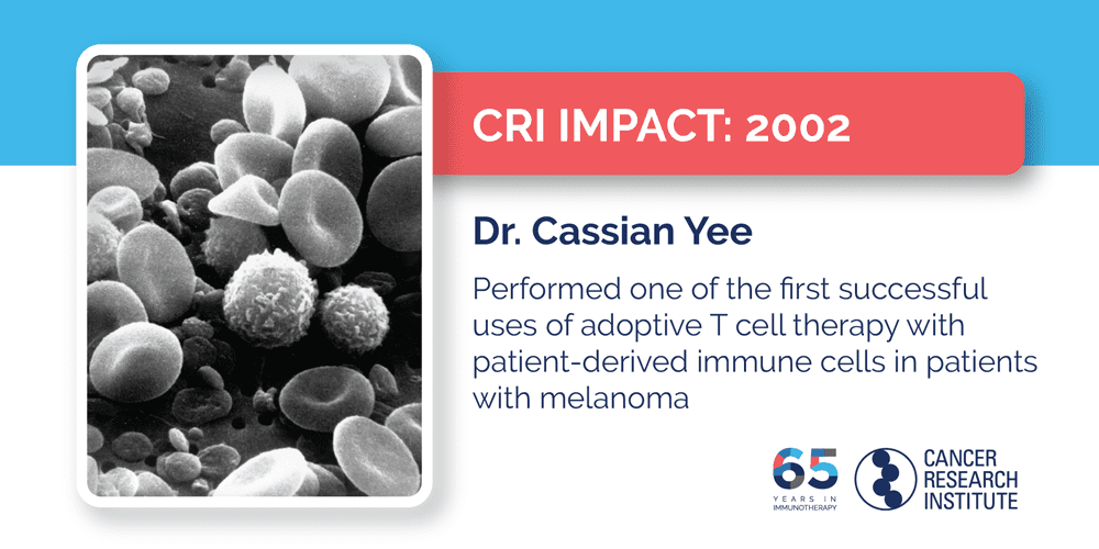 2002 Dr. Cassian Yee performed one of the first successful uses of adoptive T cell therapy with patient-derived immune cells in patients with melanoma