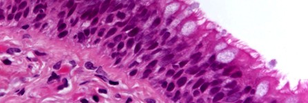 Epithelium