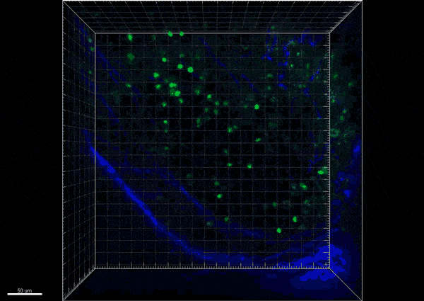NK cells attacking tumou. Credit Michele Ardolino, Brian Weist