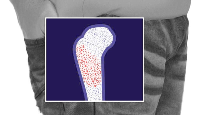 Leukemia cancer location illustration