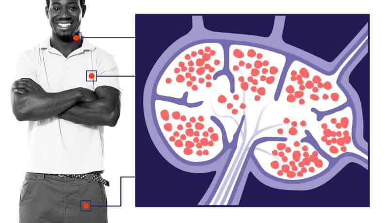 immunotherapy for lymphoma illustration