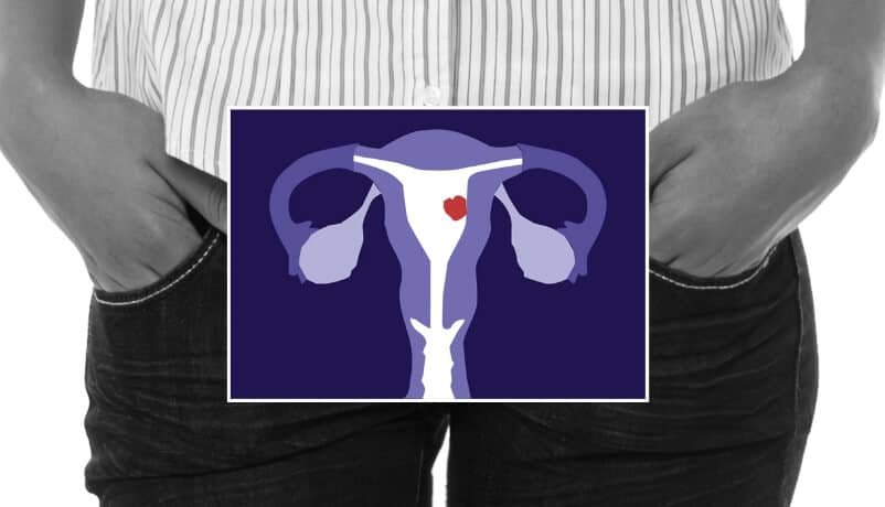 Immunotherapy for uterine cancer location illustration