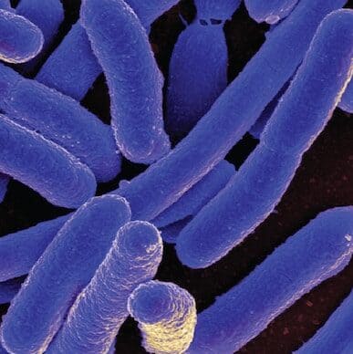 purple colorized bacteria