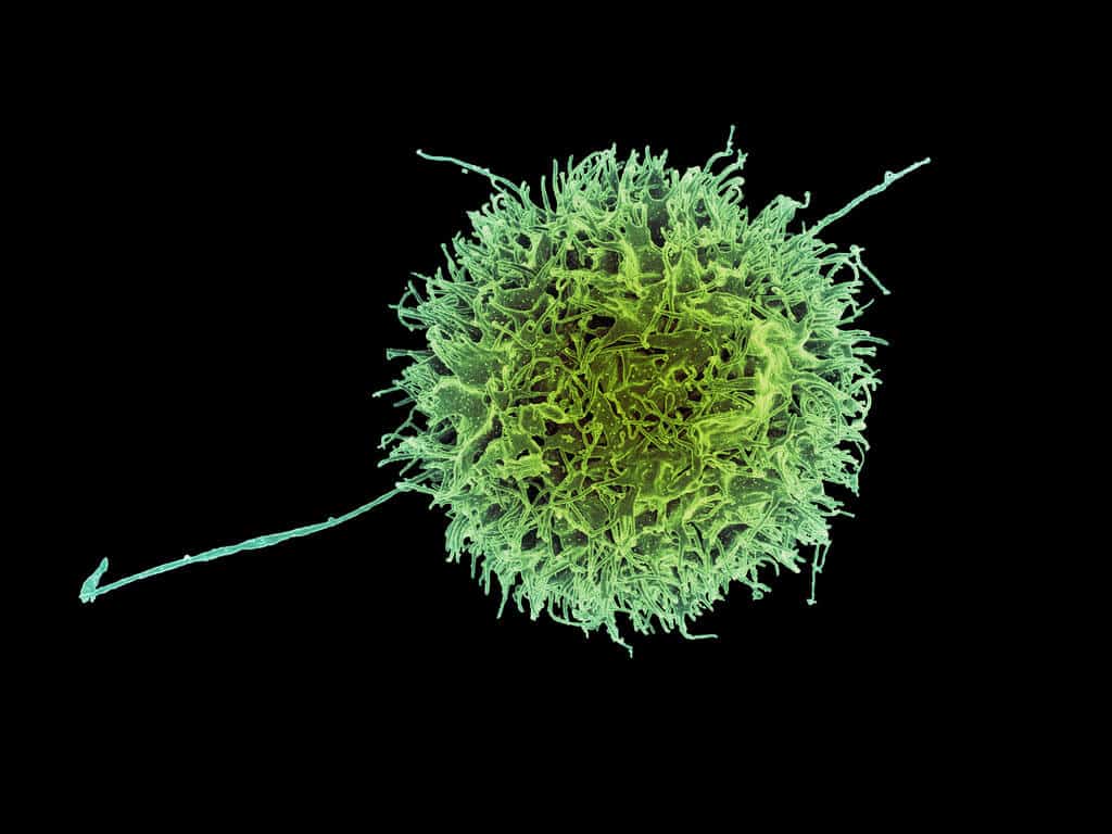 Natural Killer Cell